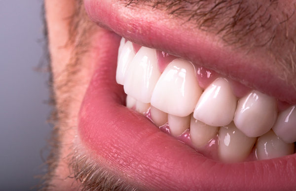 The Benefits Of CEREC Crowns: Same Day Restorations For Your Smile